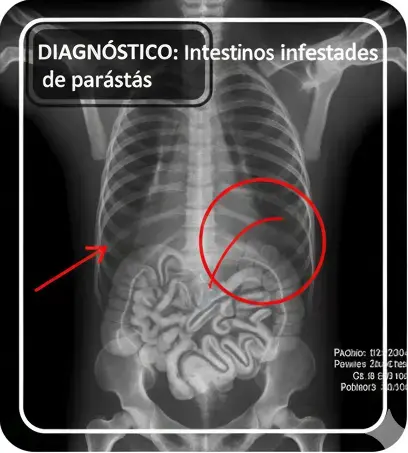 Antiparasitarios para gatos: Guía completa para proteger a tu felino en Madrid 4 pastillas para desparasitar gatos en Madrid